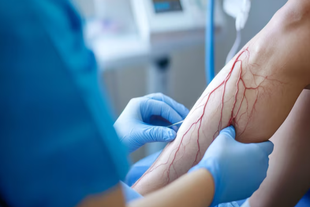 vascular surgery